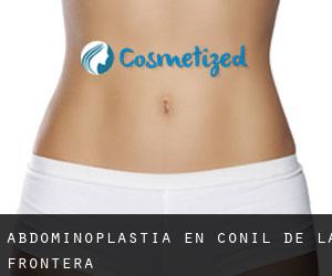 Abdominoplastia en Conil de la Frontera Abdominoplastia en Conil de la Frontera