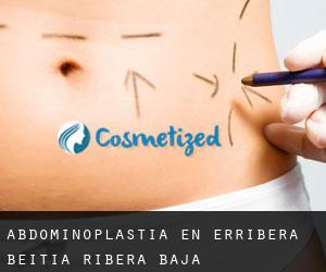 Abdominoplastia en Erribera Beitia / Ribera Baja