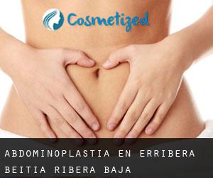 Abdominoplastia en Erribera Beitia / Ribera Baja