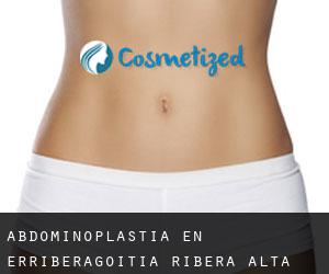Abdominoplastia en Erriberagoitia / Ribera Alta Abdominoplastia en Erriberagoitia / Ribera Alta