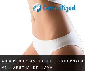 Abdominoplastia en Eskuernaga / Villabuena de Álava