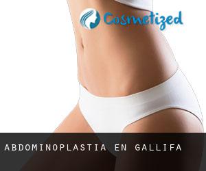 Abdominoplastia en Gallifa
