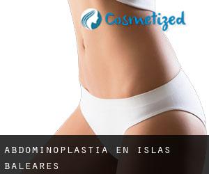 Abdominoplastia en Islas Baleares
