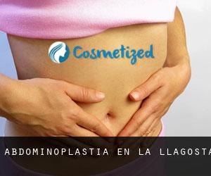 Abdominoplastia en La Llagosta