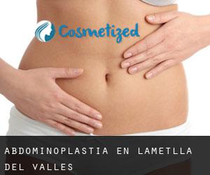 Abdominoplastia en L'Ametlla del Vallès