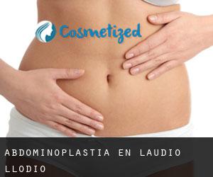 Abdominoplastia en Laudio / Llodio