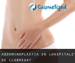 Abdominoplastia en L'Hospitalet de Llobregat