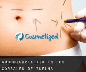 Abdominoplastia en Los Corrales de Buelna