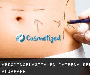 Abdominoplastia en Mairena del Aljarafe