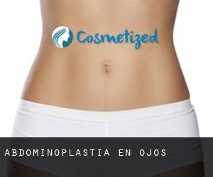 Abdominoplastia en Ojós Abdominoplastia en Ojós