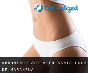 Abdominoplastia en Santa Cruz de Marchena