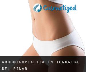 Abdominoplastia en Torralba del Pinar