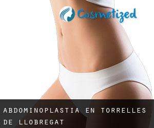 Abdominoplastia en Torrelles de Llobregat
