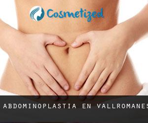 Abdominoplastia en Vallromanes