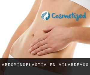 Abdominoplastia en Vilardevós Abdominoplastia en Vilardevós